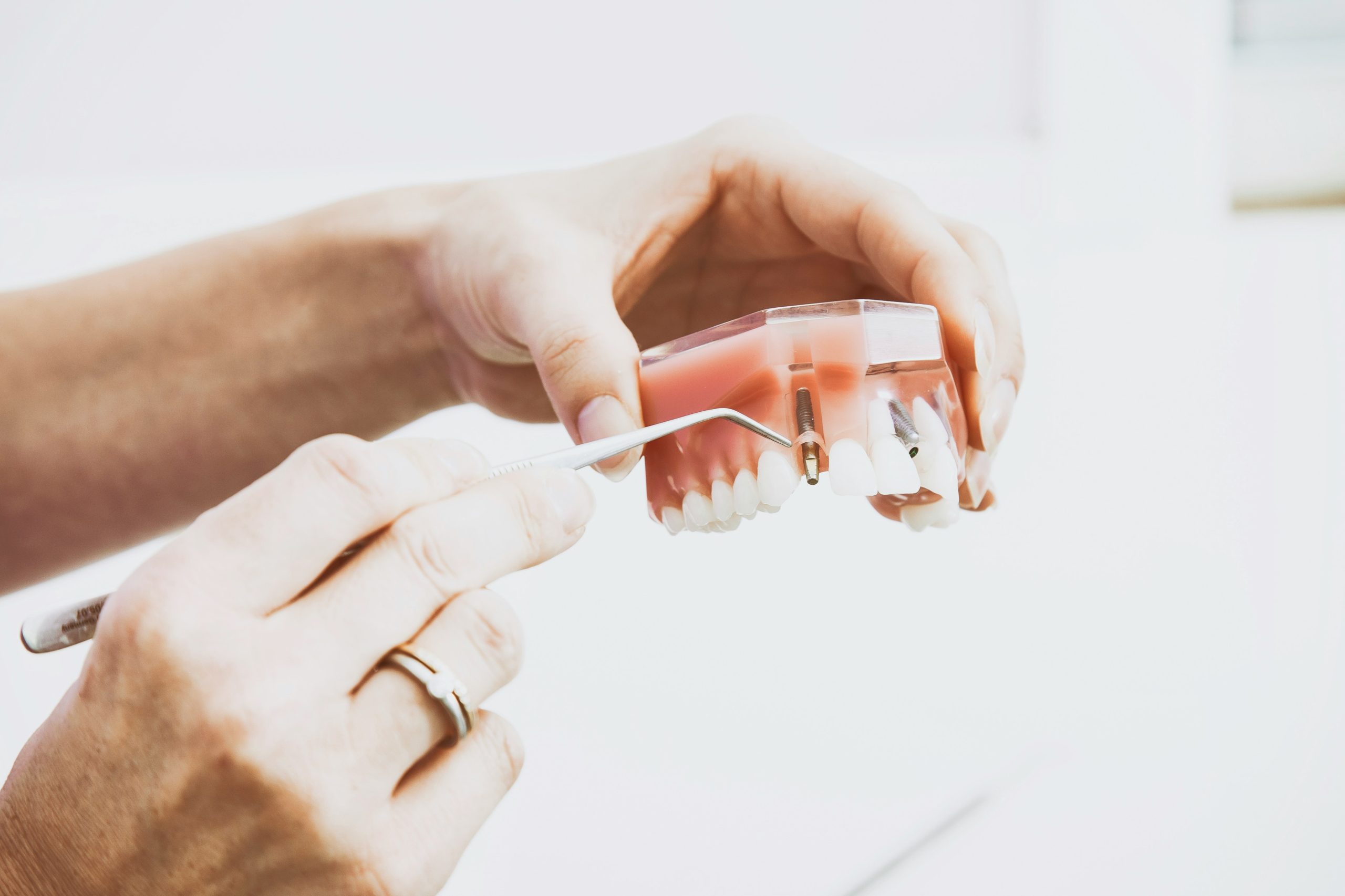 Konya implant tedavisi örneği
